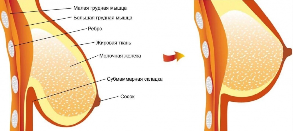 строение молочной железы до и после мастопексии